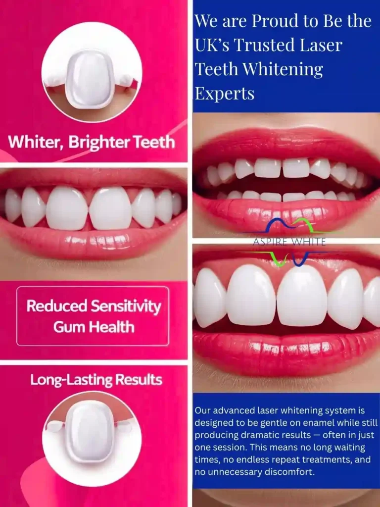 We are Proud to Be the UK’s Trusted Laser Teeth Whitening Experts Newport